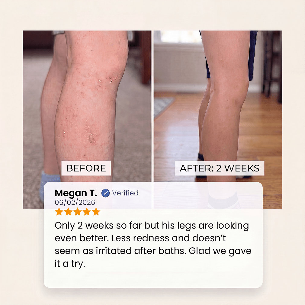 Customer before-and-after photos showing a child’s legs after two weeks of using the Evolved H2O bath filter, alongside a verified review