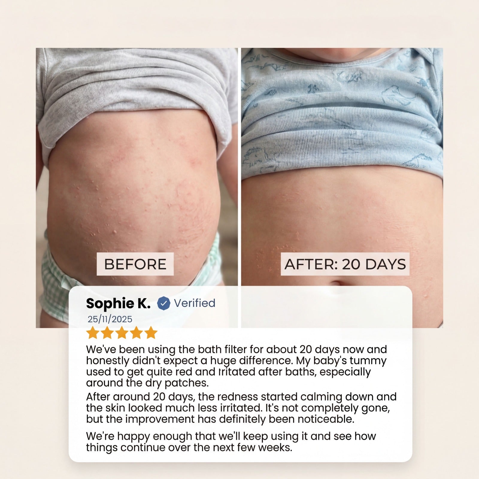 Customer before-and-after photos showing a baby’s abdominal skin after 20 days of using the Evolved H2O bath filter, alongside a verified review