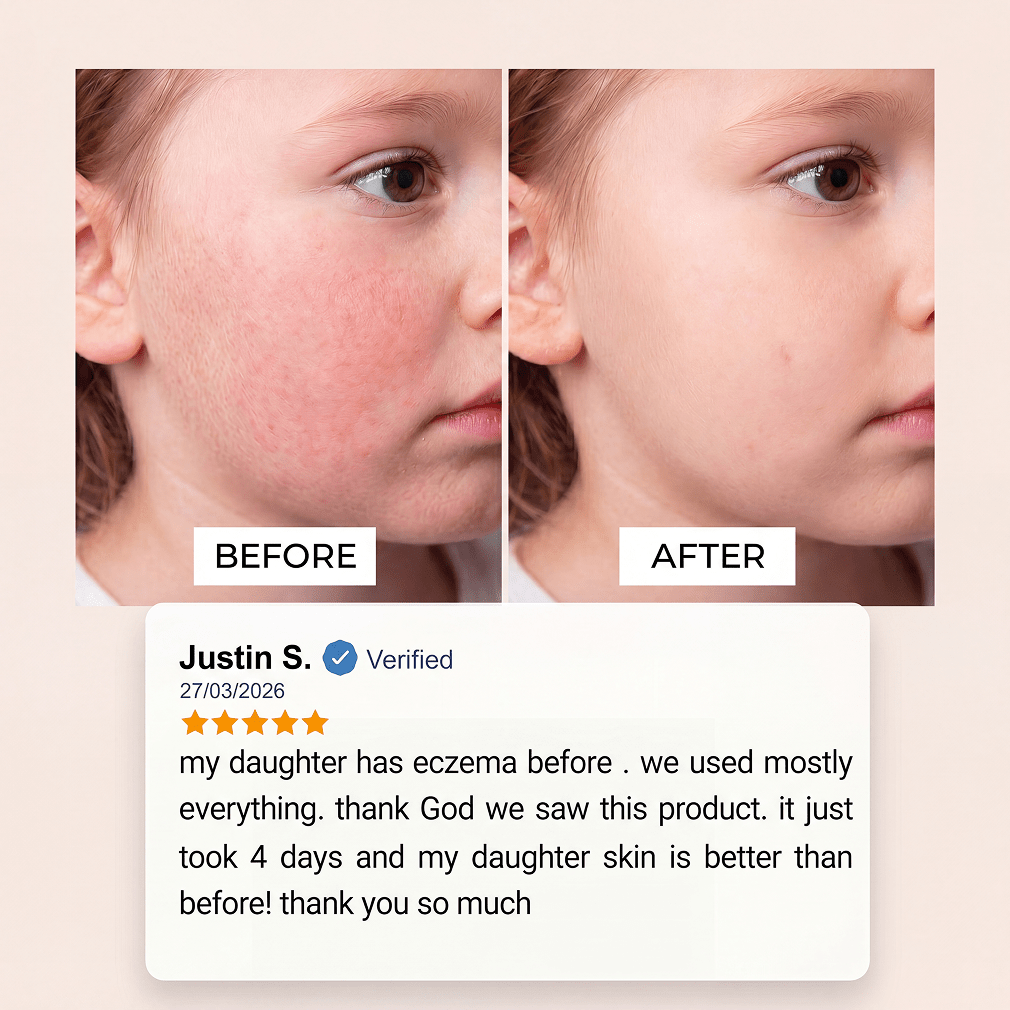Customer before-and-after photos showing a child’s facial skin alongside a verified review after using the Evolved H2O bath filter