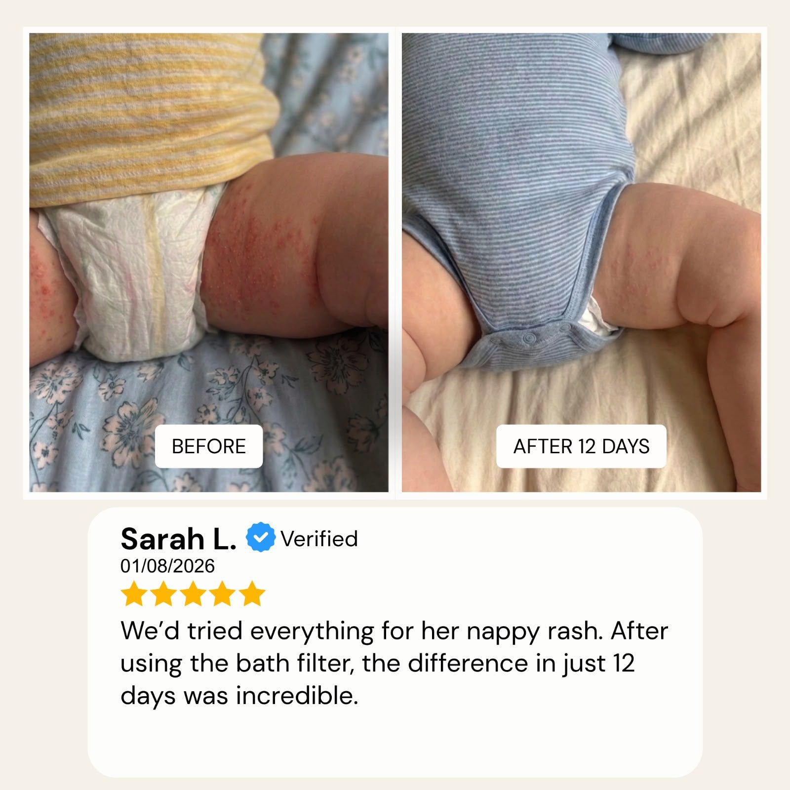 Customer-submitted before-and-after photos of a baby’s skin taken 12 days apart, shown with a verified Evolved H2O Bath Filter review.