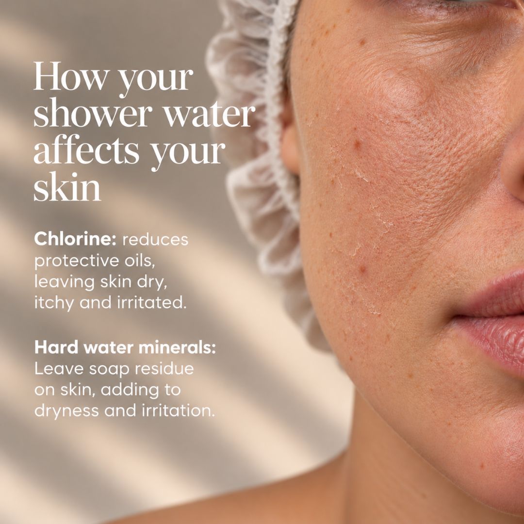 Close-up of dry, irritated facial skin with text explaining how chlorine and hard water minerals can affect skin