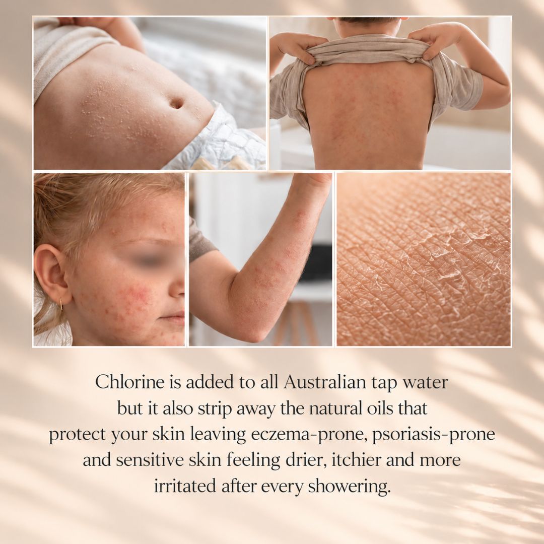 Collage showing dry, irritated and sensitive skin in children, including redness, rash and flaky skin