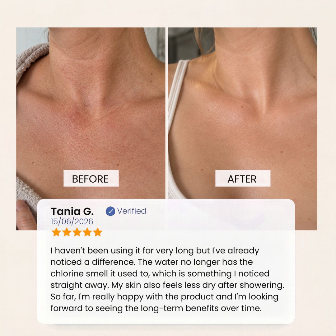 Before-and-after chest and neck skin comparison with a verified Evolved H2O shower filter customer review describing less dryness and reduced chlorine smell