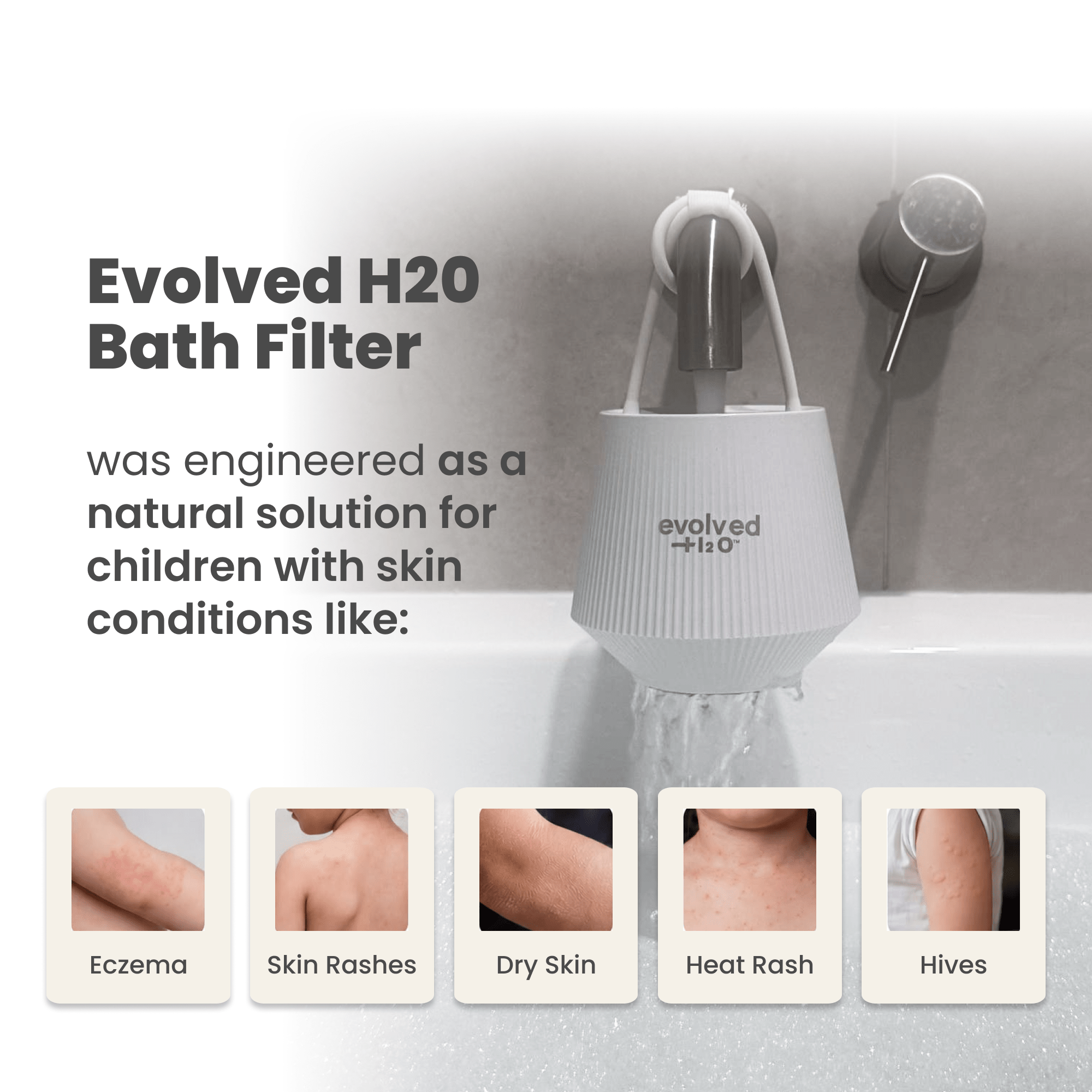 Evolved H2O bath filter running under a bath tap with text about eczema, rashes, dry skin, heat rash and hives in children
