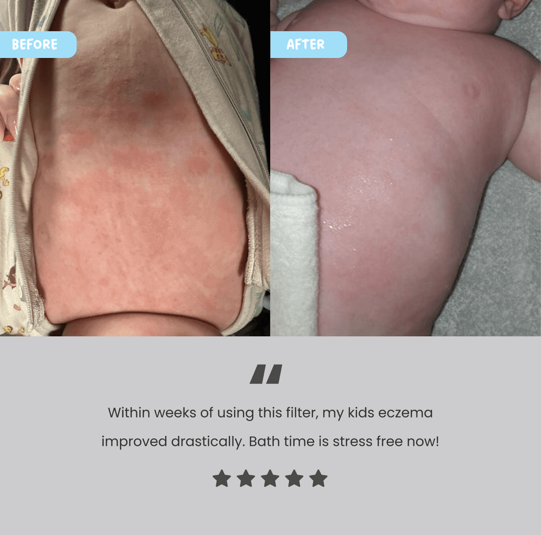 Customer-submitted before-and-after photos showing a baby’s skin alongside a five-star bath filter review