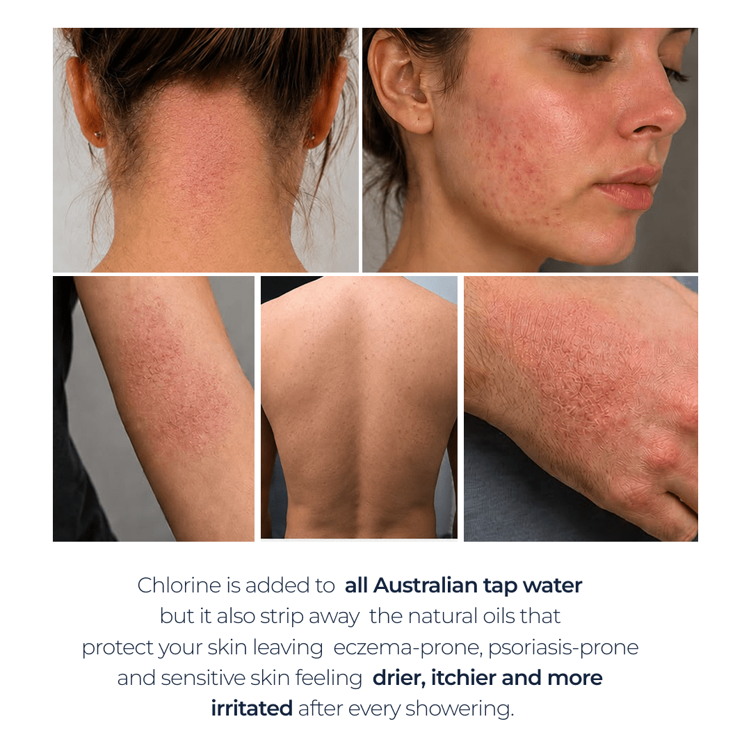 Collage showing dry, red and irritated skin with text about chlorine in Australian tap water and skin sensitivity